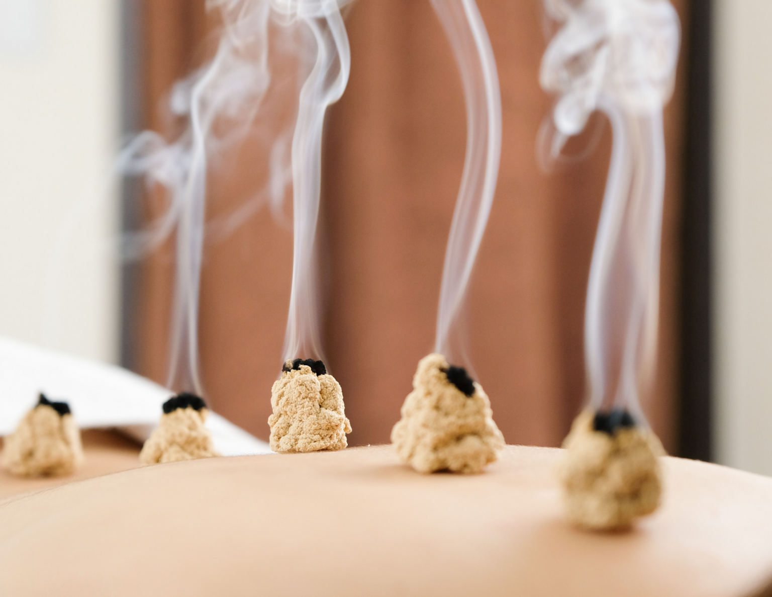 Moxibustion-1536×1187